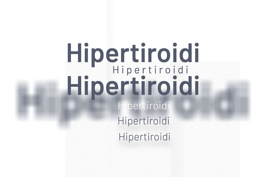 Hipertiroidizm